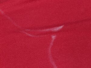 ワキ汗の多汗症治療はどれが効果的？比較してみた！